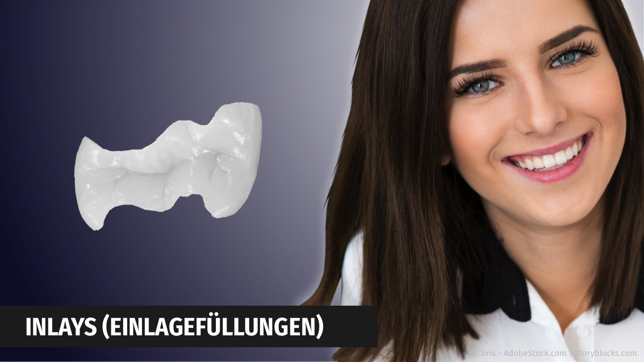 Keramik-Inlays (Einlagefüllungen) mit CEREC herstellen